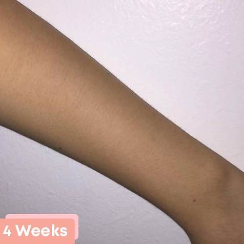 Arm